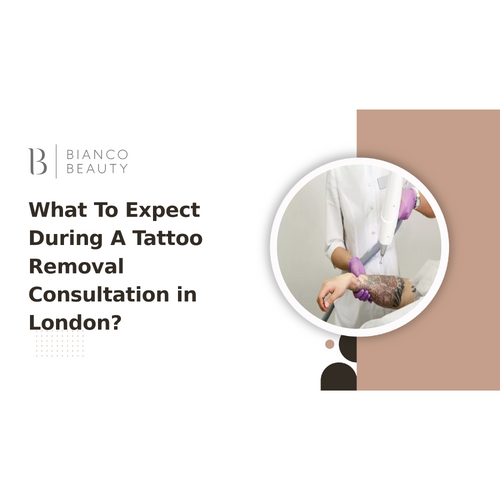 What To Expect During A Tattoo Removal Consultation in London?