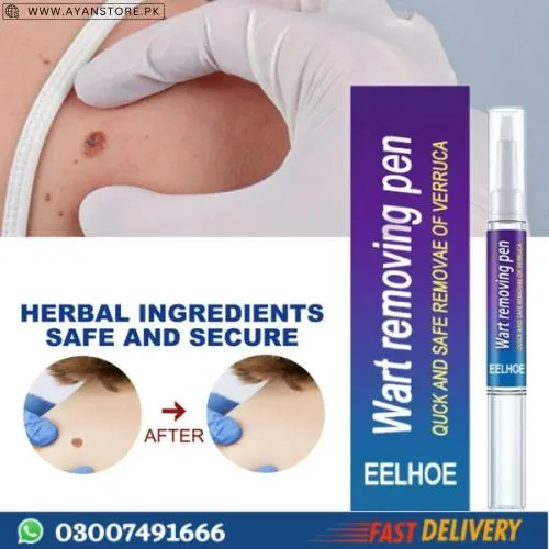 Wart Removing Pen Price in Pakistan Buy Now - AyanStore.PK